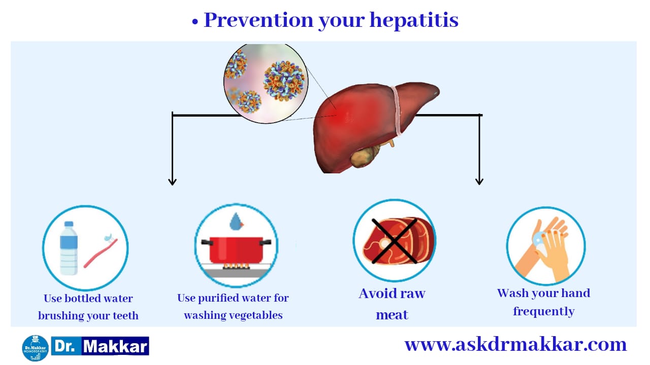 Hepatitis B Liver Cirrhosis Homeopathic Treatment India